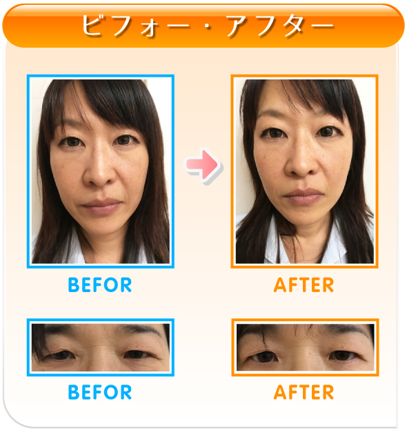 ビフォー・アフター